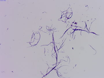 Smooth Muscle Breakaway W.M