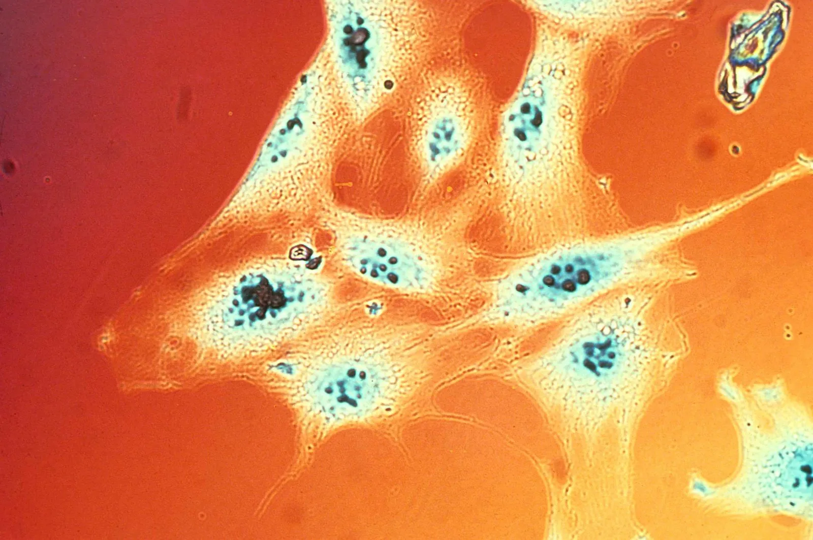 Digital Microscopy: How Microscope Cameras Changed Modern Observation